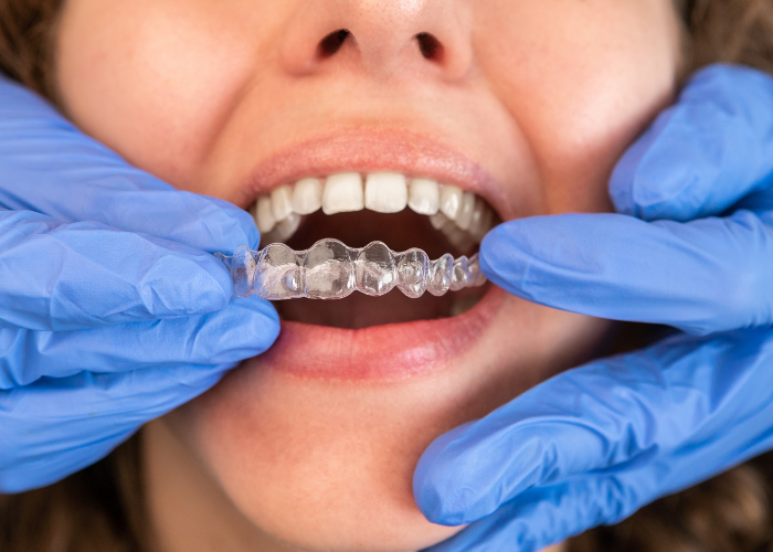 Invisalign Bundoora