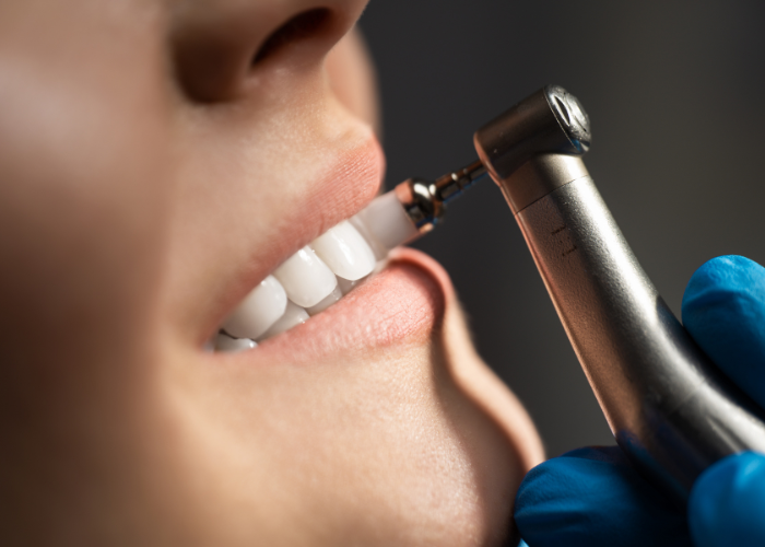 Dental Whitening Bundoora