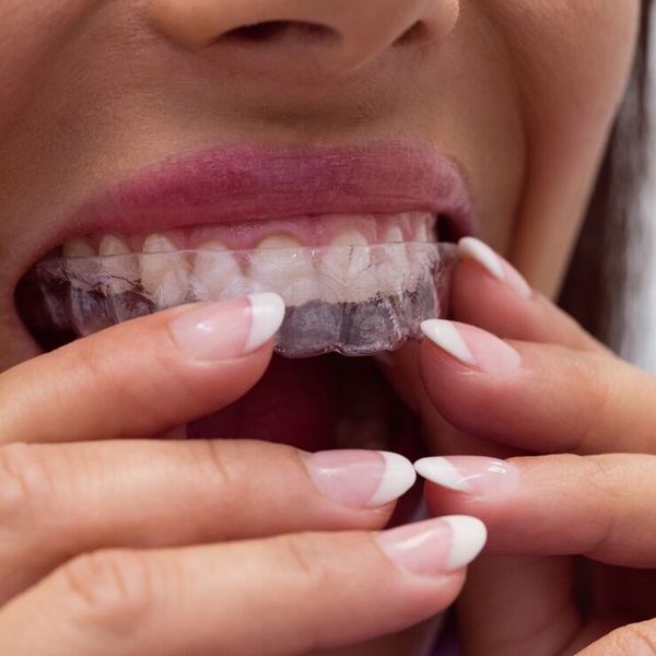female-patient-wearing-braces_107420-65482